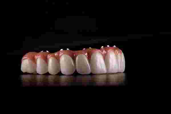 dental implants Rochdale 