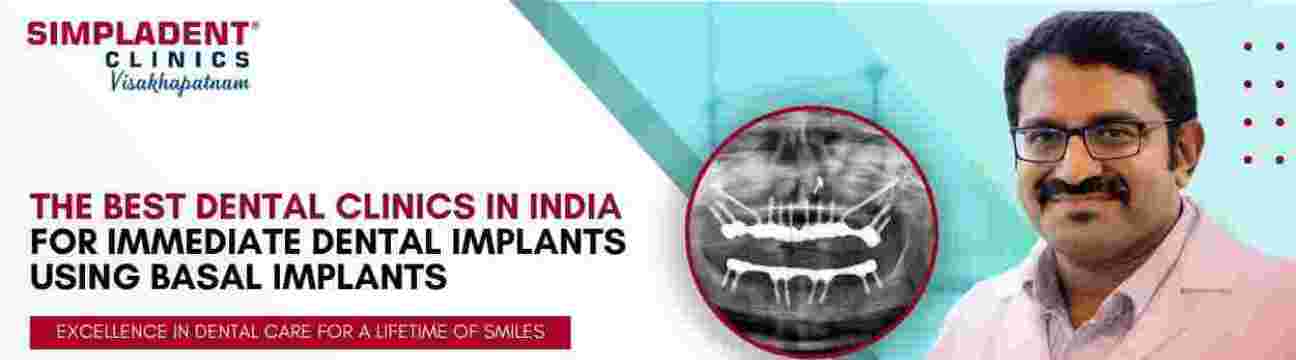 Best Dental Implant  Clinic in Visakhapatnam